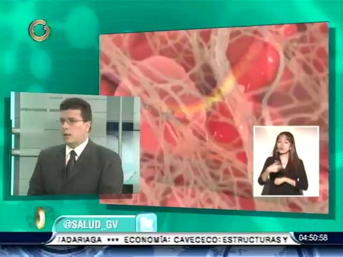 ¿Cuáles son las causas de las várices?