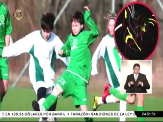 Cardiólogo: 34 de cada 100 personas sufren de hipertensión arterial en Venezuela