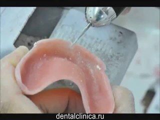 Clinic of Aesthetic Dentistry hi-tech технология изготовления зубных протезов
