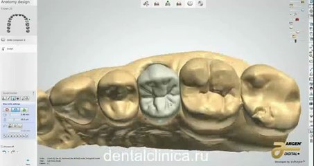 Hi-Tech моделирование протезирование имплантация European Clinic of Aesthetic Dentistry