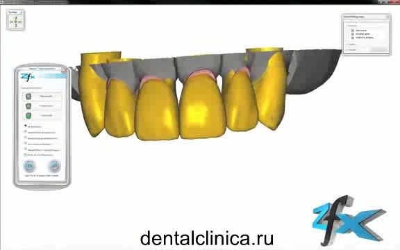 Клиника эстетической стоматологии дентальной имплантации в Будапеште CAD моделирование