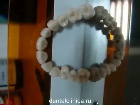 Клиника эстетической стоматологии дентальной имплантации в Будапеште отдых и лечение