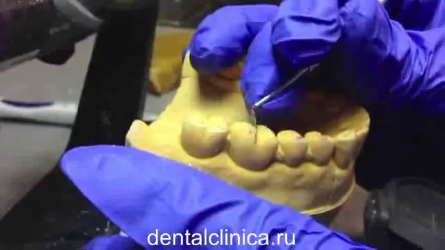 Клиника эстетической стоматологии, протезирование в лаборатории новых технологий