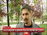 Kendisini gözünden vuran polisi çekti ama