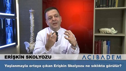 Yaşlanmayla ortaya çıkan Erişkin Skolyozu ne sıklıkta görülür?