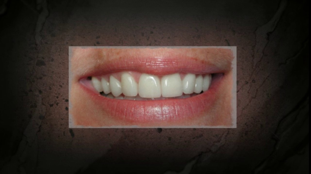 Boulder Cosmetic Dentistry Jan2014