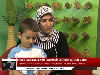 BADEMCİK RAHATSIZLIĞI VARDI ŞİFALI BİTKİLERİ KULLANDI