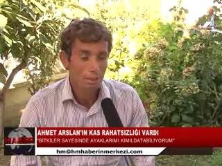 KAS RAHATSIZLIĞI VARDI ŞİFALI BİTKİLERİ KULLANDI