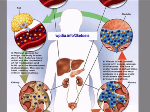 KETOSIS - what is ketosis - ketosis and weight loss
