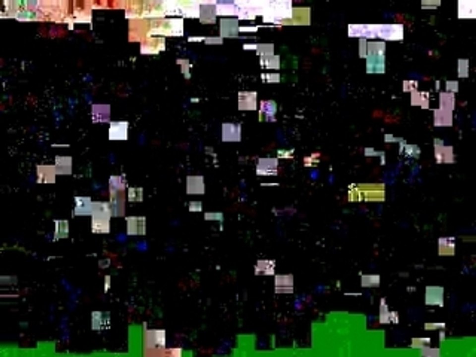 TBS - Twenty-Twenty Surgery (MTV Live)