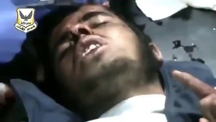 مجاهد يتلو القرآن وهو مصاب لايتوقف عن الدعاء وتلاوة القران