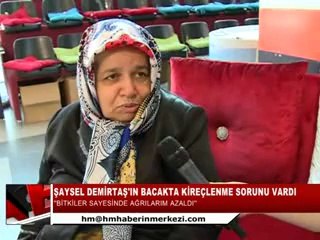 29-ŞAYSEL DEMİRTAŞ - BACAKTA KİREÇLENME