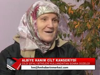 31-ALBİYE KÜÇÜKYILMAZ - CİLT KANSERİ