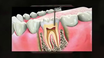 Johnstown Ohio Dentist  |  Dr. Jeffrey R. Jaicks DDS