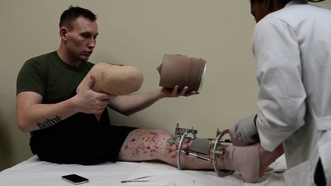 Healing wounds