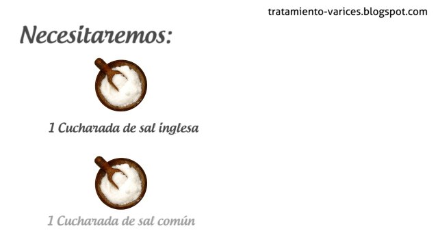 Remedios caseros contra las várices