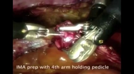 Catherine Mohr_ Surgery's past, present and robotic future