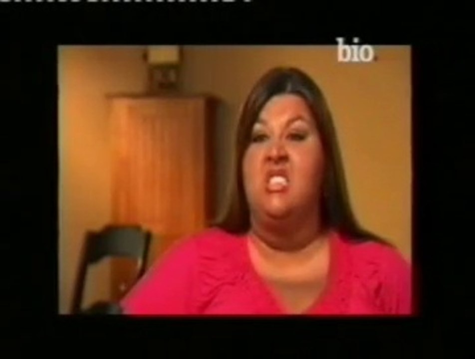 Obesidad morbida: Sally