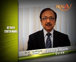 Dr. V. L. Upadhayay shared about best solution for getting rid of Stretch Marks