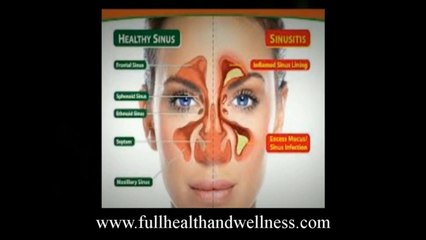 How To Get Rid Of A Stuffy Nose Easily_ End The Discomfort O