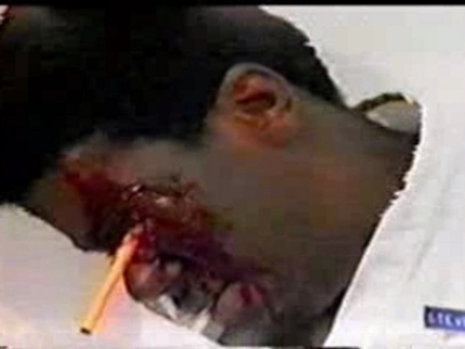 Autopsy - Critical Madness