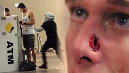 YouTube 'Prank' Ends in Broken Nose, Endless Hate