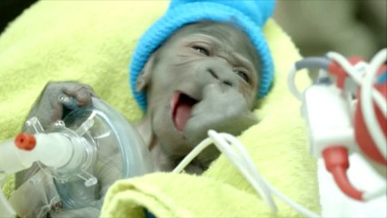 Naissance d'un bébé gorille par césarienne