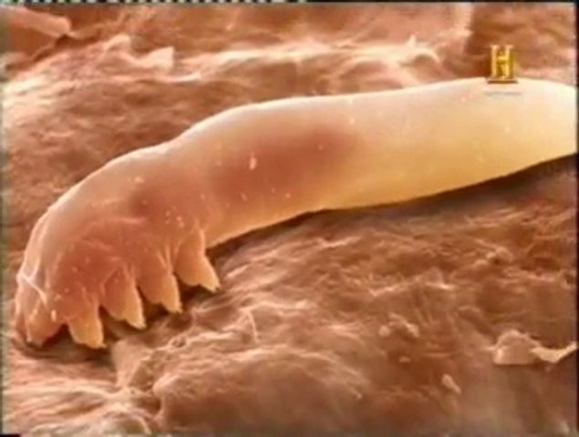 Regenerador prometedor Inyección Piel humana: Vida microscopica (Demodex folliculorum) - Vídeo Dailymotion