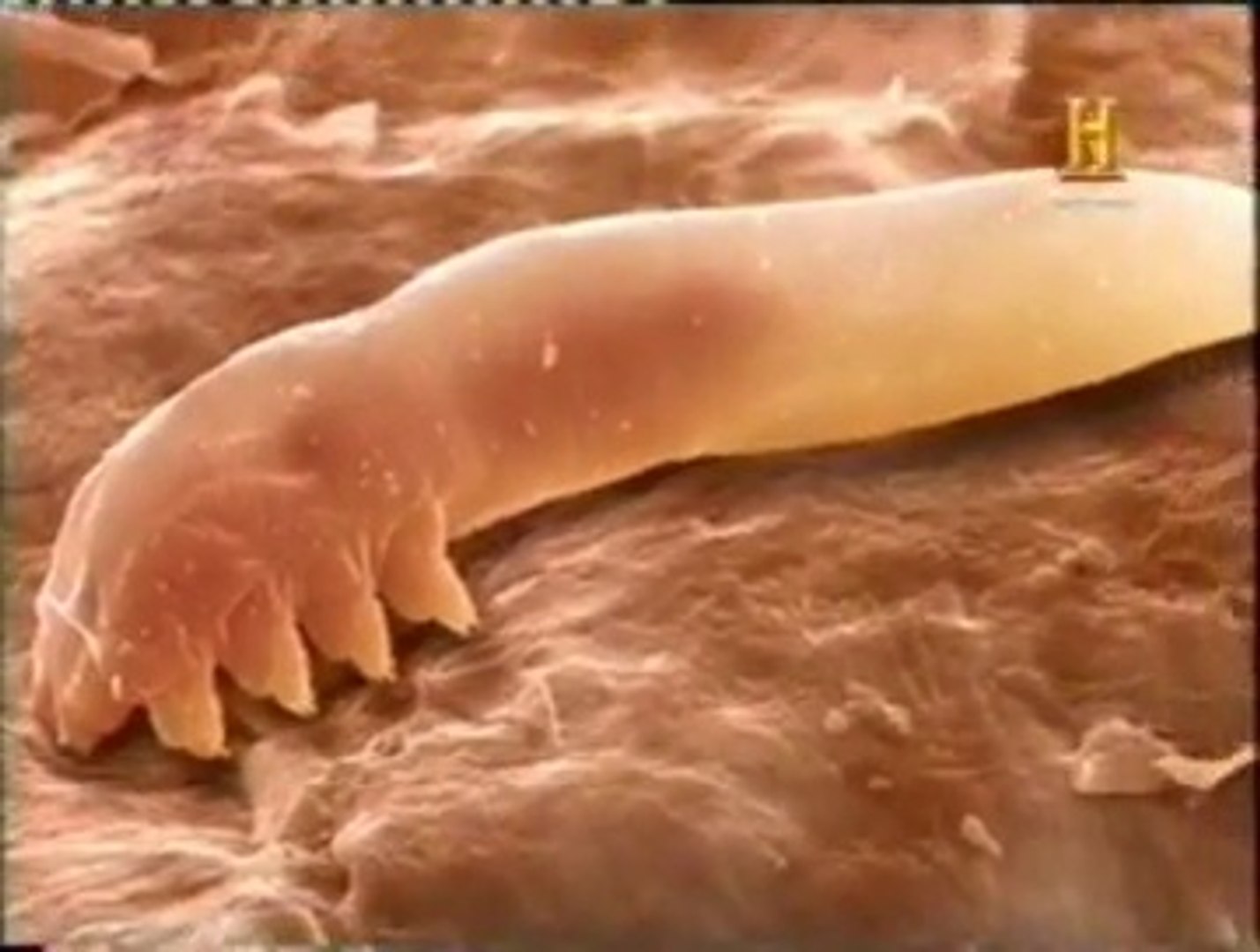 Piel humana: Vida microscopica (Demodex folliculorum) - Vídeo Dailymotion