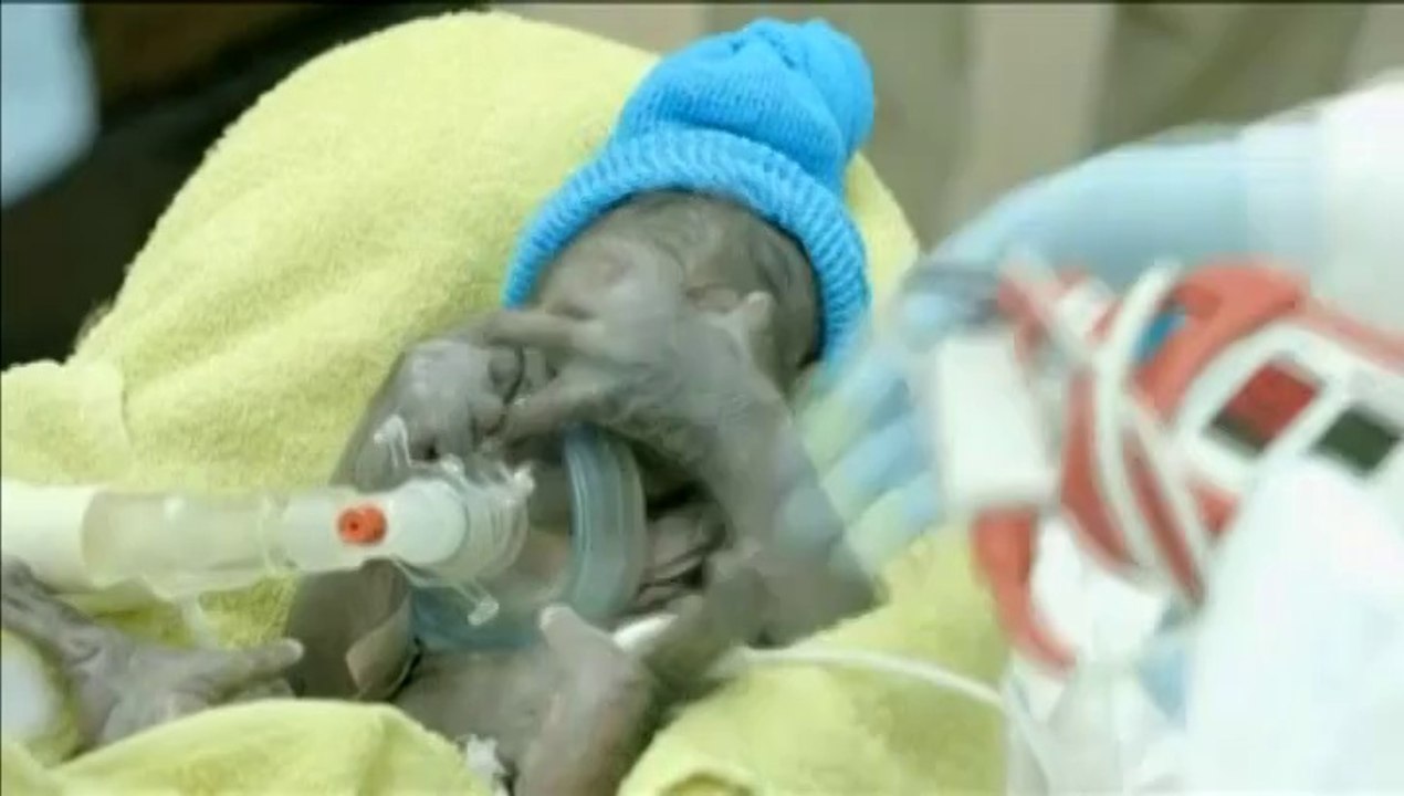 Etats-Unis : un bébé gorille naît par césarienne