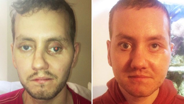 Gesicht aus dem 3-D-Drucker: Moderne Technik hilft Chirurgen