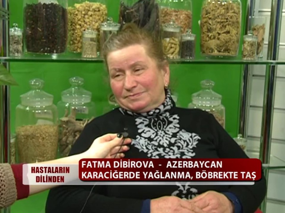 FATMA DİBİROVA