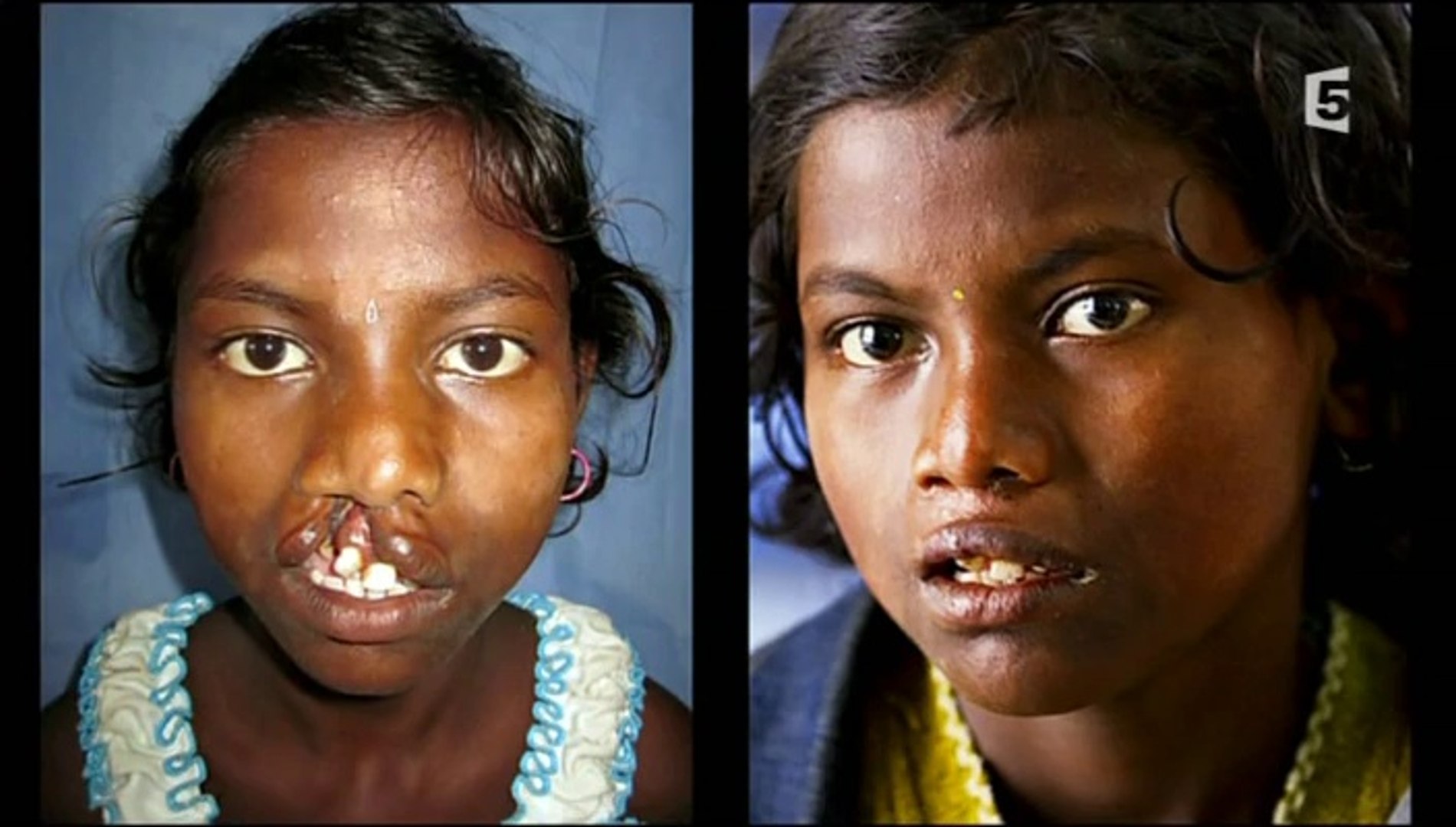 Le Corps Humain Video Dailymotion