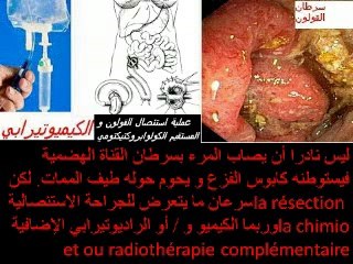 Les marqueurs sanguins tumoraux en cancérologie digestive