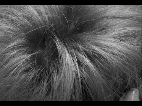 Myths & facts about hair loss