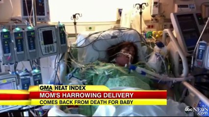 Mother Dies While Delivering Baby — And Lives To Tell About It