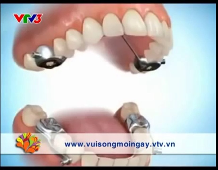 dich vu lam video clip gioi thieu benh vien - LH: 0915 782 785    – Ms Lan