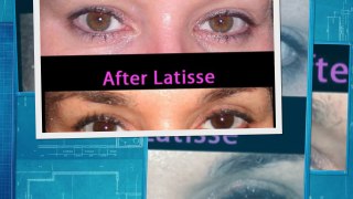 Buy Latisse Generic Online 0.03, 3 ML Eye Drops - Safemeds4all