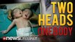 TWO HEADS: Rare Conjoined Twins Born in India Share One Body