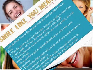 All on 4 Dental Implants and the process