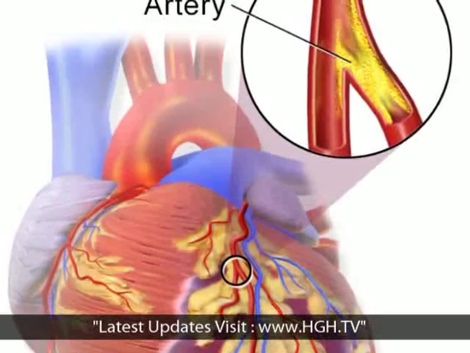 HGH Declines with Aging