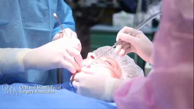 Jaw Surgery - Montgomery, Prattville, Troy - Orthognathic Surgery