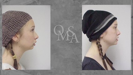 TMJ Treatment - Montgomery, Prattville, Troy - TMJ Disorder