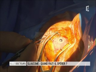 Chirurgie du glaucome: une trabéculectomie (Dr Jacques Laloum, émission Allo-Docteurs 04-02-2014)