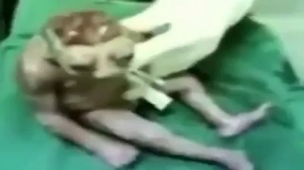 Torso half body frogs and half human babies born