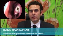 Lazerle Burun Ameliyatı Videosu-subtitled-Turbinate reduction surgery with Holmium laser
