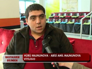 VİTİLİGO RAHATSIZLIĞI VARDI ŞİFALI BİTKİLERİ KULLANDI