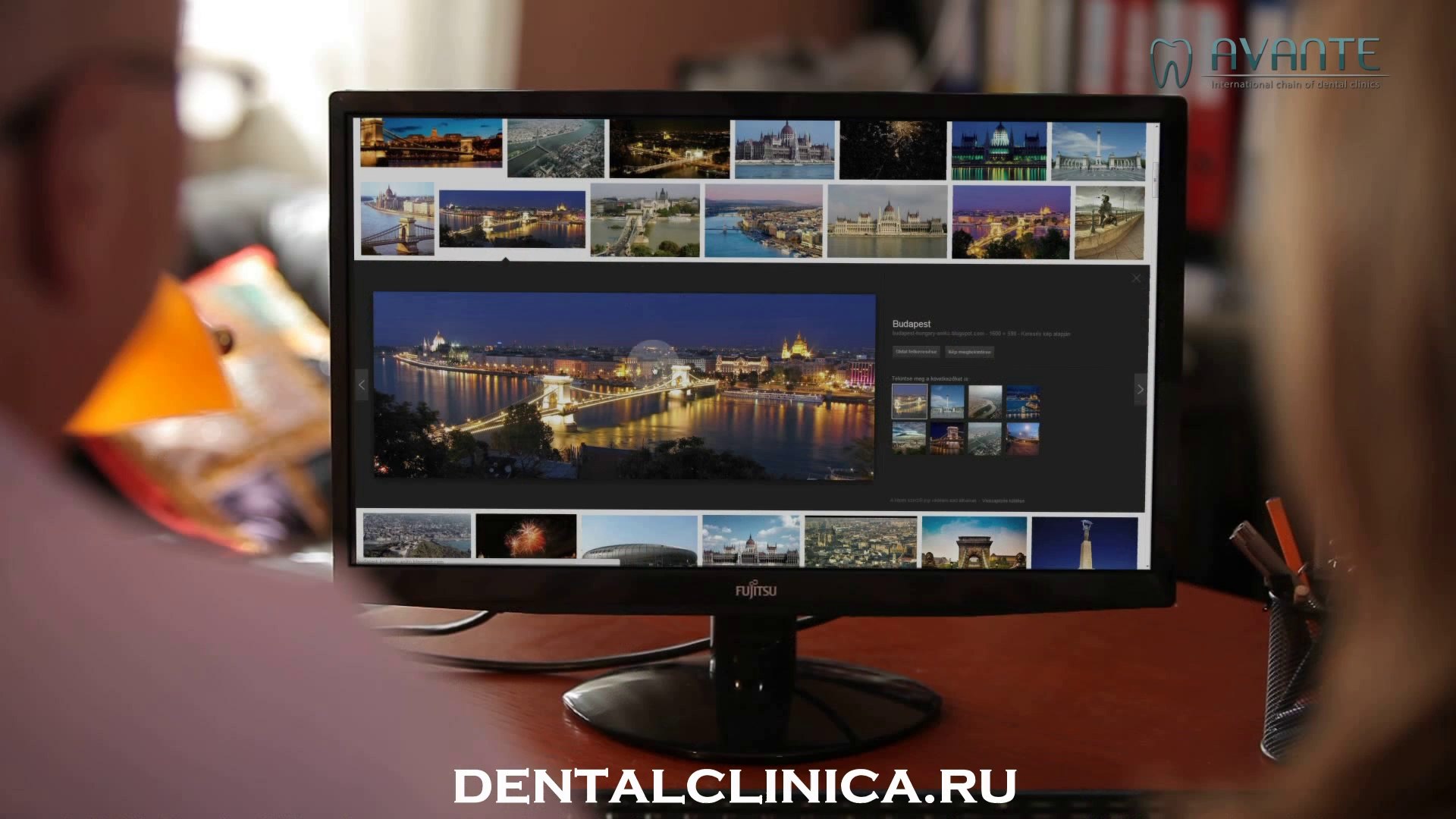 ⁣European Clinic of Aesthetic Dentistry in Budapest “Jewel Dental” “AVANTE” Стоматология лечение прот
