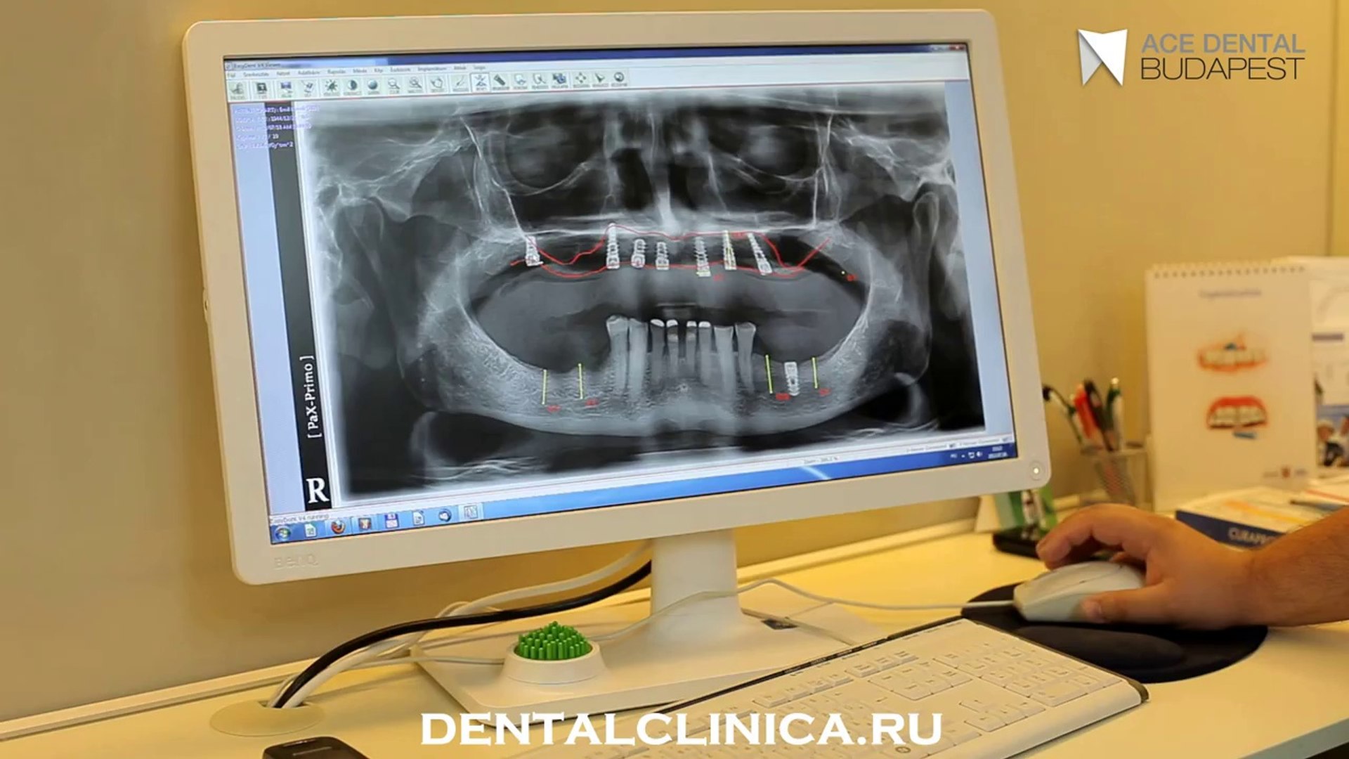 ⁣European Clinic of Aesthetic Dentistry in Budapest “Jewel Dental” “AVANTE” Лечебный курортный туризм