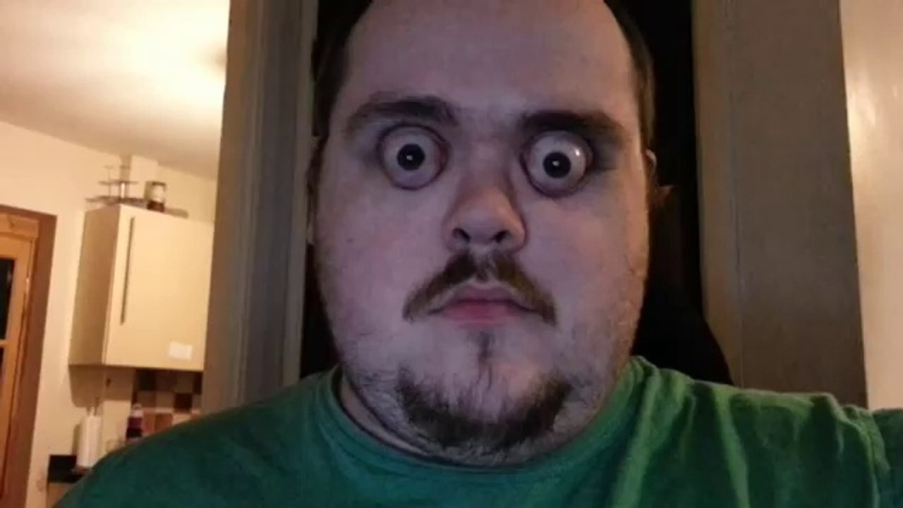 MAN POPS OUT EYES TO DAFT PUNK